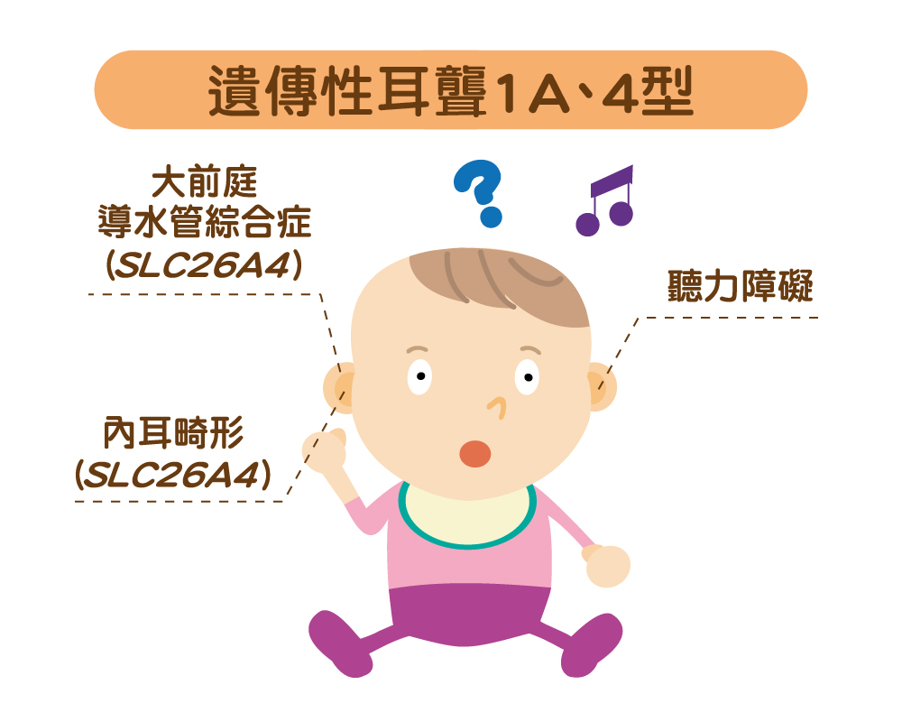 遺傳性耳聾1A、4型