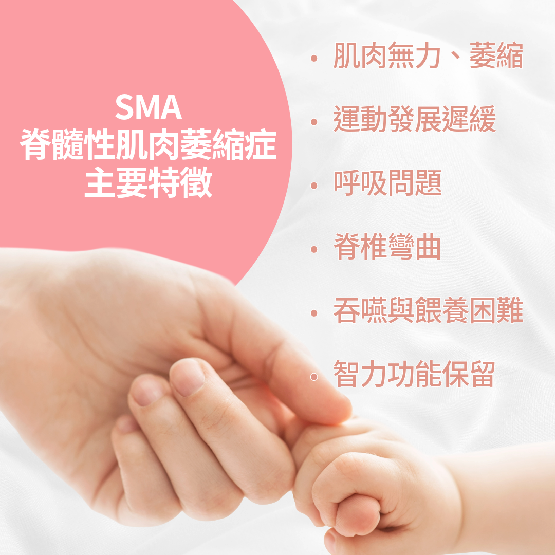 SMA 脊髓性肌肉萎縮症的主要特徵